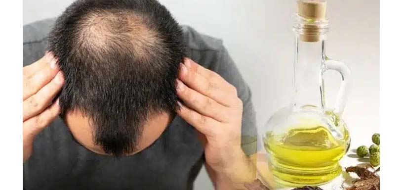 Rosemary-Oil for Hair-Growth